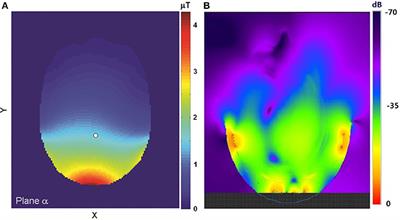 High Field In vivo13C Magnetic Resonance Spectroscopy of Brain by Random Radiofrequency Heteronuclear Decoupling and Data Undersampling